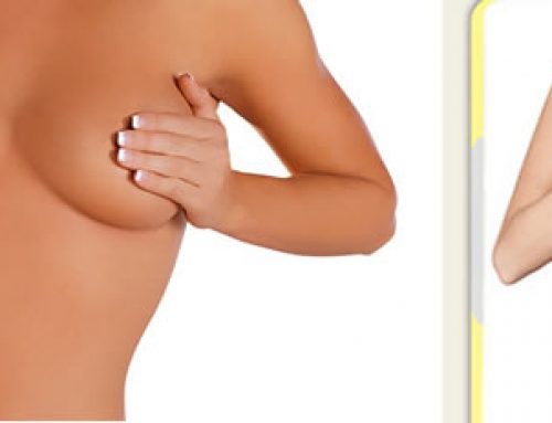 Misconceptions About Breast Augmentation and Lift